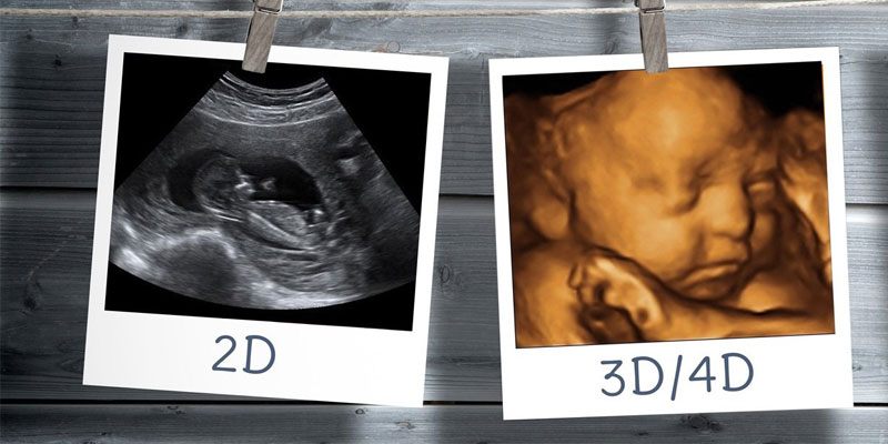 3d 4d